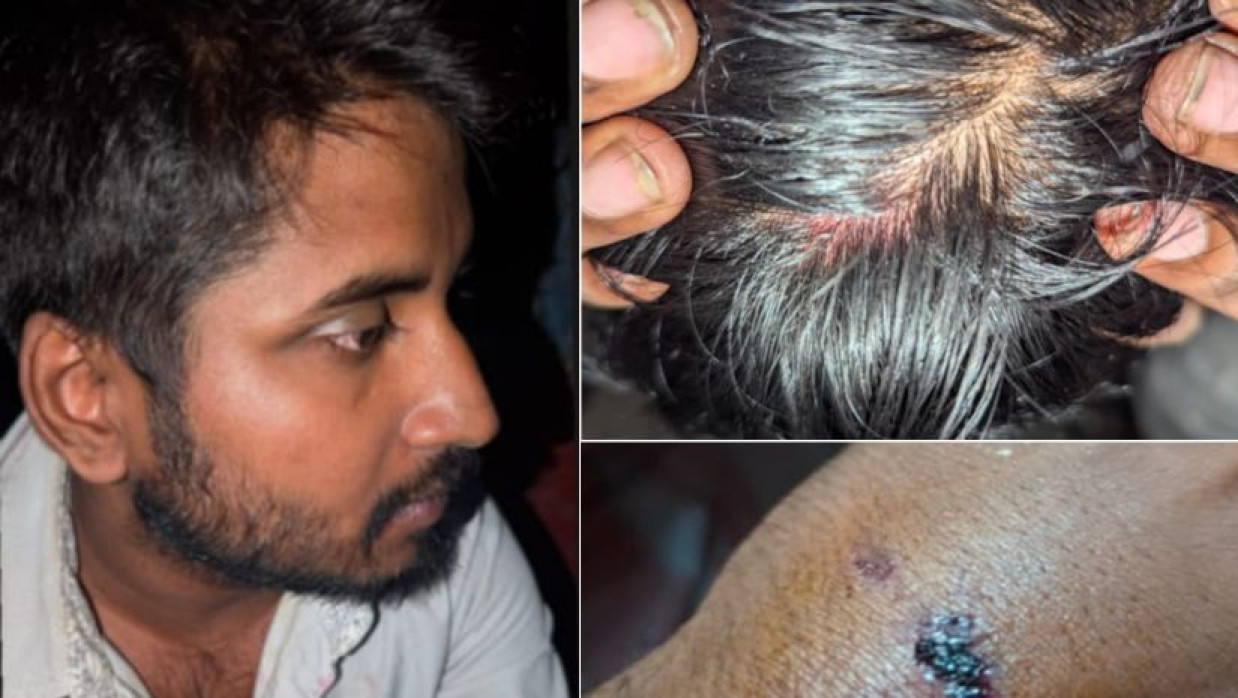 মো. মোসাব্বির হোসেন ও তার শরীরে আঘাতের চিহ্ন