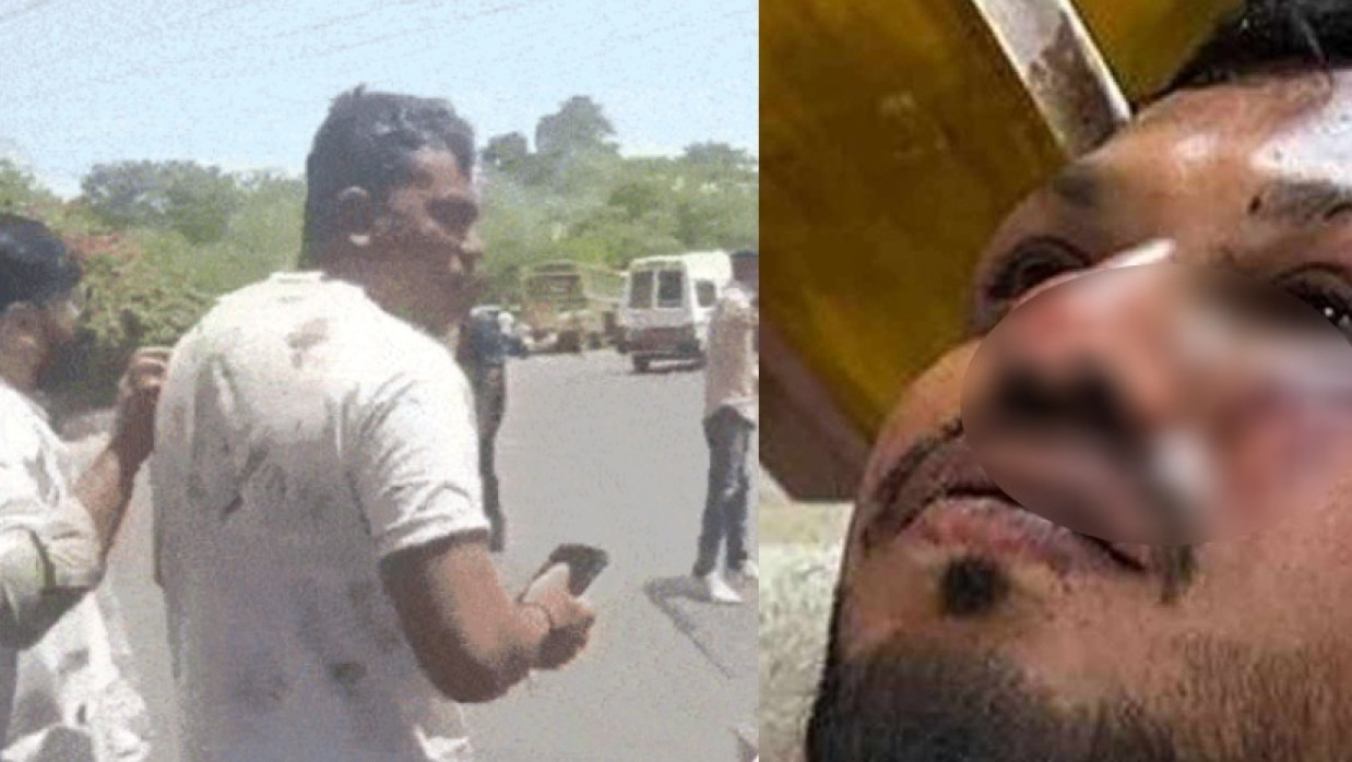 বিমান দুর্ঘটনায় বেঁচে গিয়েছেন এক যাত্রী