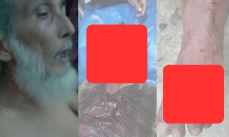 জমি নিয়ে বিরোধের জেরে হামলায় অবসরপ্রাপ্ত প্রধান শিক্ষকসহ আহত ৫