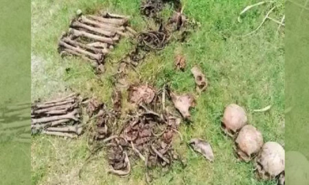 ময়লার স্তুপে থাকা ব্যাগ থেকে মানুষের মাথার খুলি উদ্ধার 