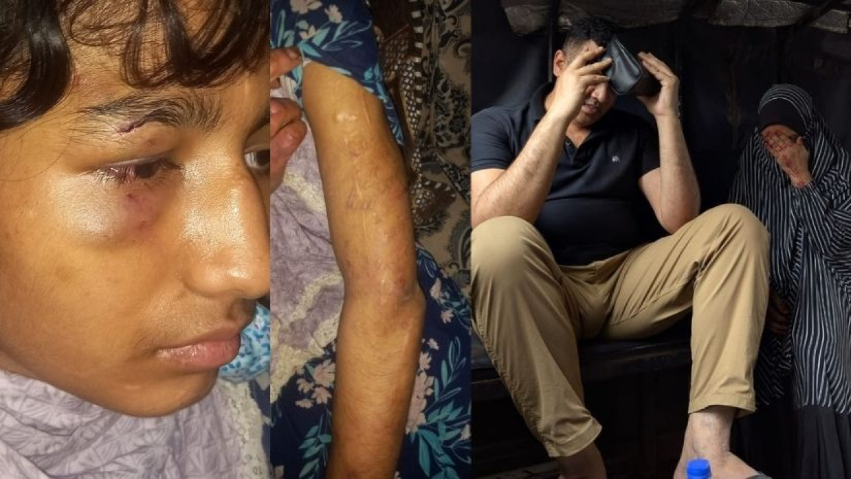 নির্যাতনের শিকার রানী ও নজরুল ইসলাম-রেশমা