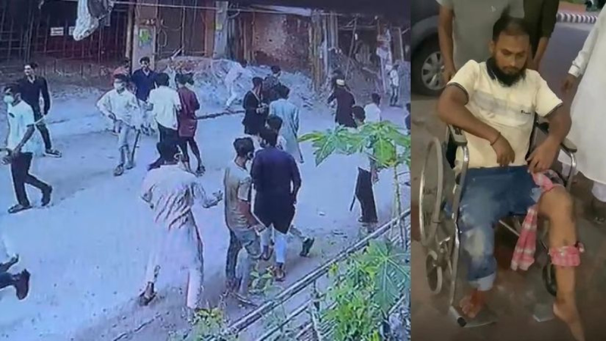 গুলিবিদ্ধ  শরিফুল ইসলাম