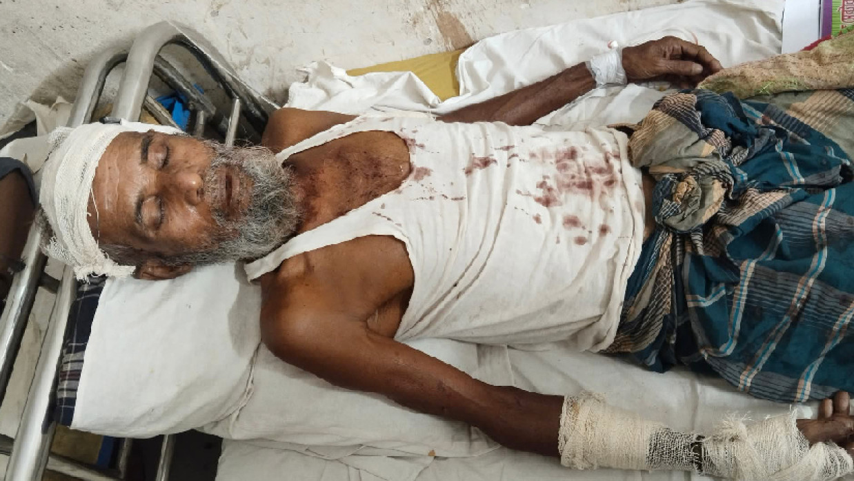 গুরুতর আহত আলী আকবর ওরফে কাঞ্চন মিয়াজী