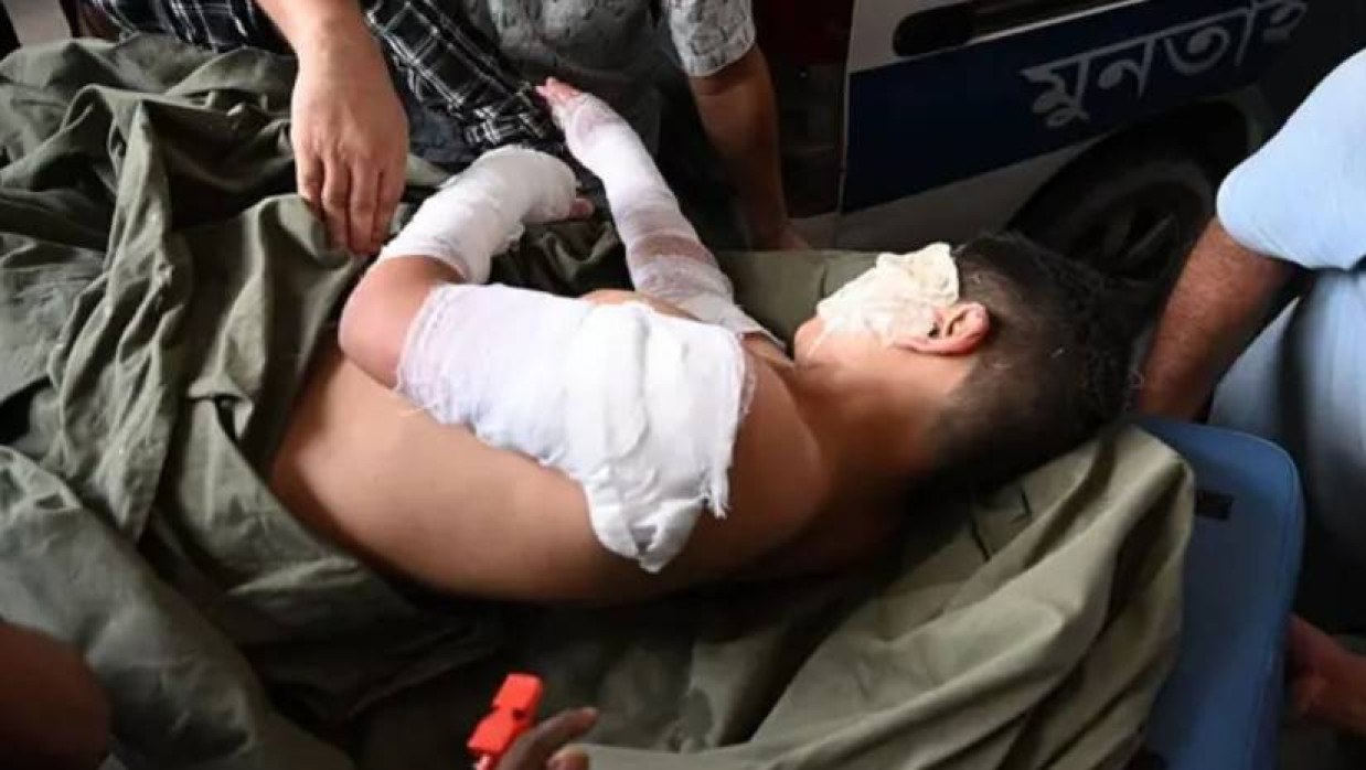 মাইলস্টোন স্কুলে বিমান বিধ্বস্ত হয়ে অগ্নিদগ্ধ শিক্ষার্থীদের অনেকের শরীরে ৫০ থেকে ৯৫ শতাংশ পর্যন্ত পুড়ে গেছে