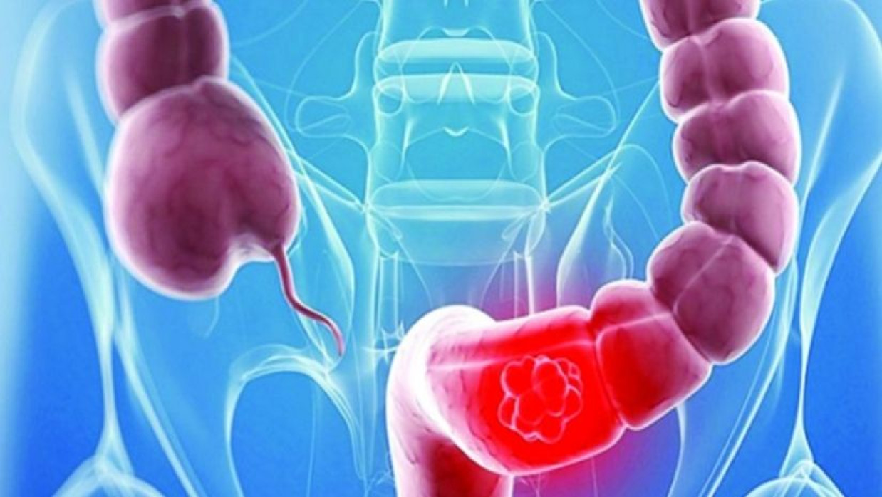 প্রতীকি ছবি