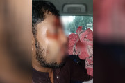 গোপালগঞ্জে হামলায় এনসিপির কেন্দ্রীয় সংগঠক নয়ন আহত