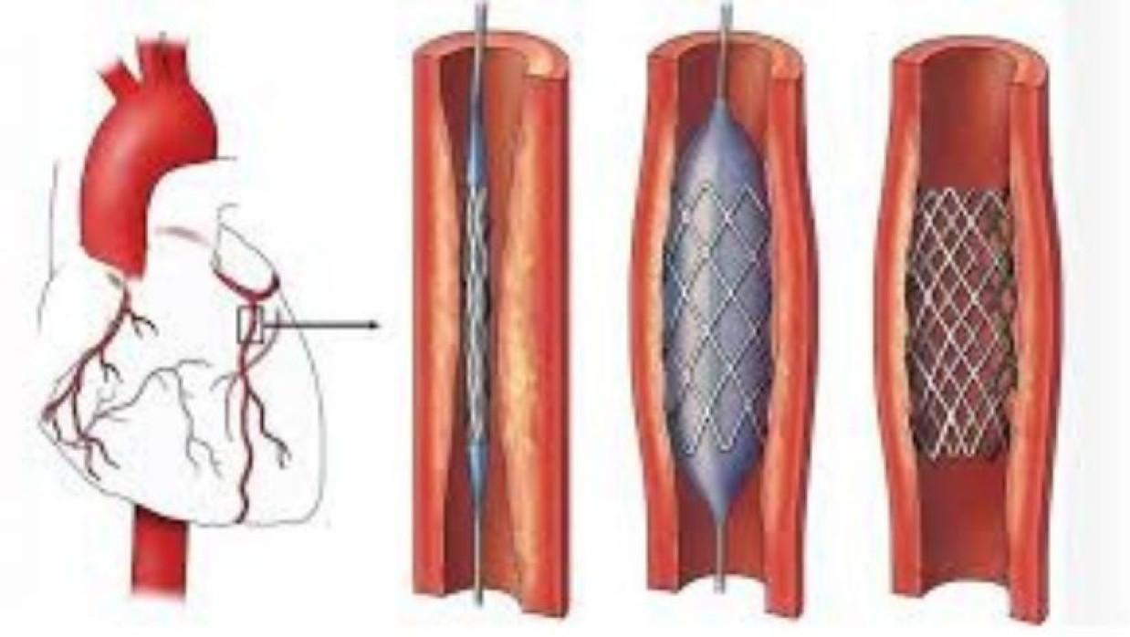 প্রতীকী ছবি