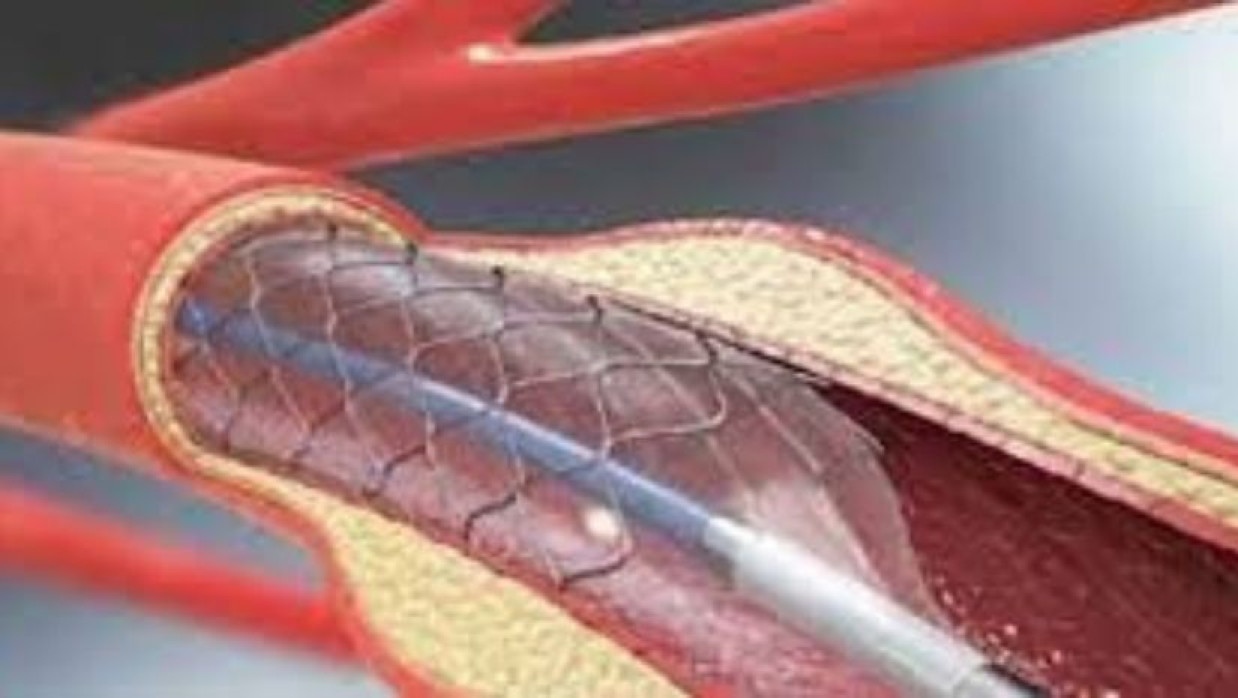 প্রতীকী ছবি 