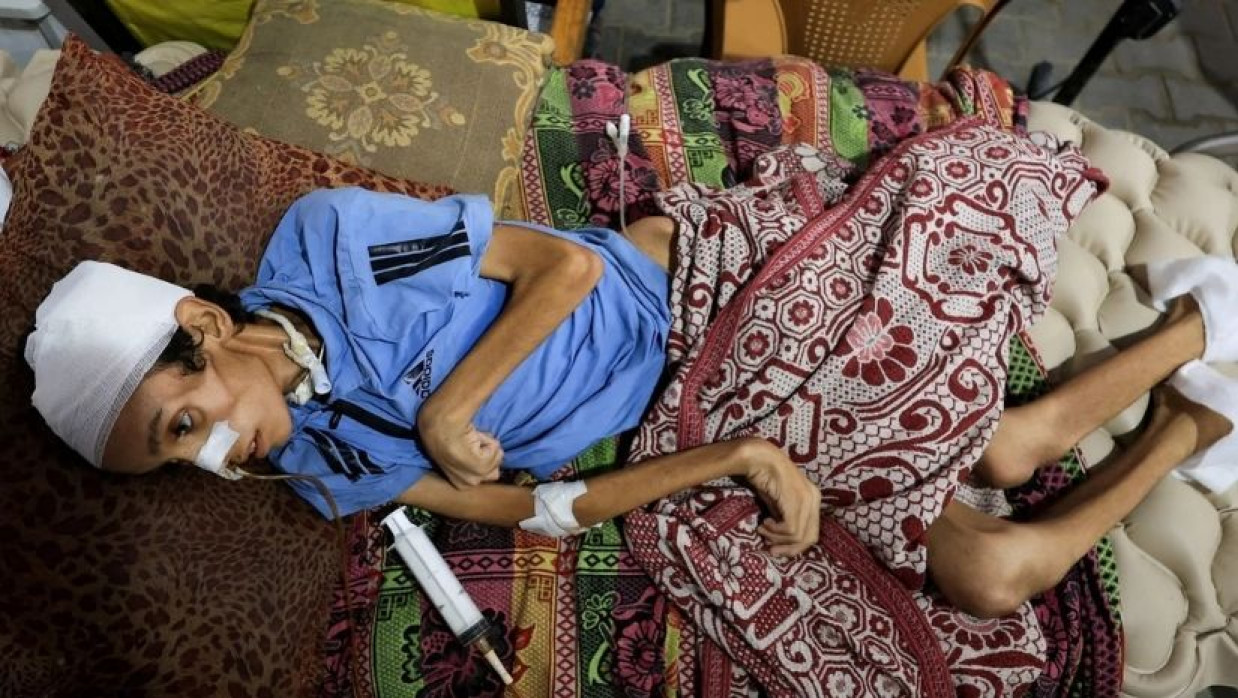 গাজায় ক্রমেই বাড়ছে অনাহারে মৃতের সংখ্যা