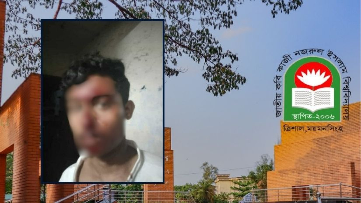 জাতীয় কবি কাজী নজরুল ইসলাম বিশ্ববিদ্যালয়ে মারামারিতে আহত  সমাজবিজ্ঞান বিভাগের শিক্ষার্থী আকাশ দেবনাথ