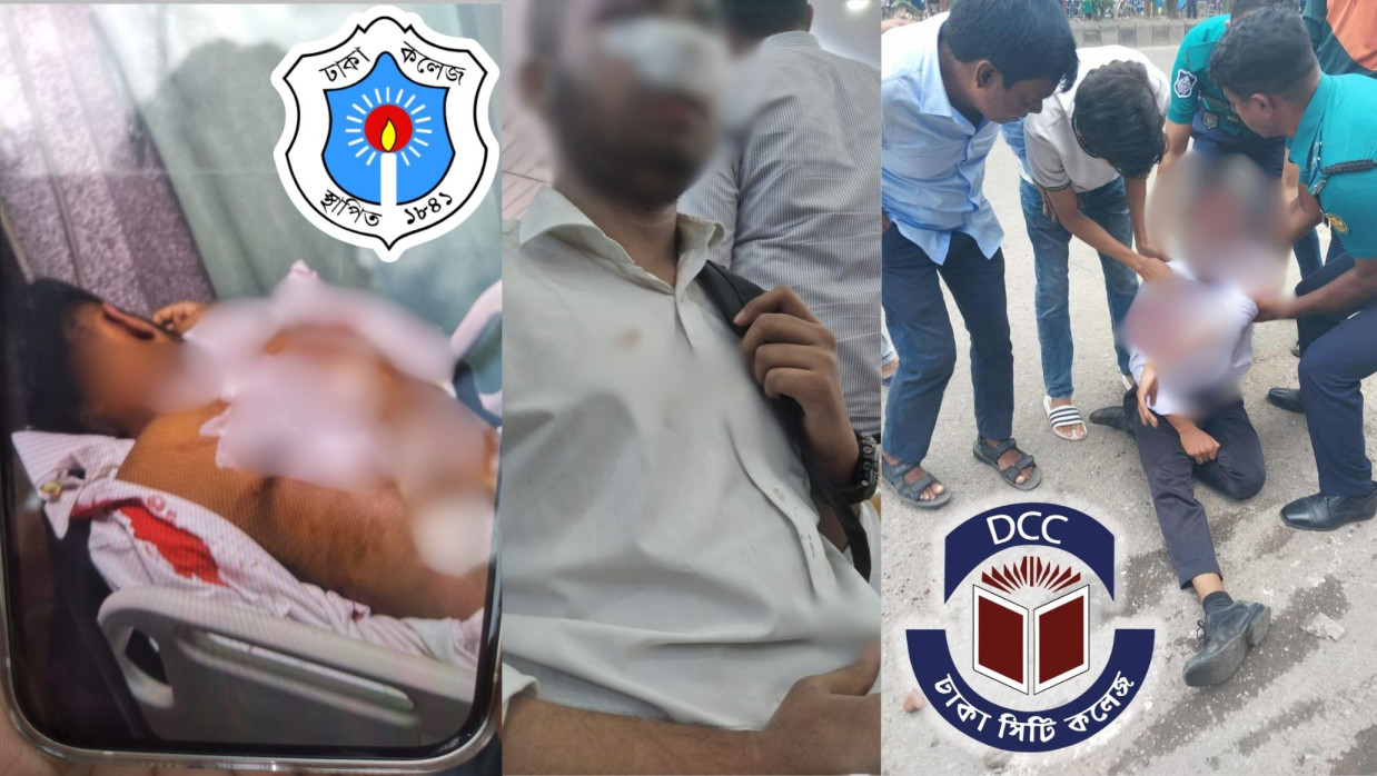 সংঘর্ষে আহত তিন শিক্ষার্থী