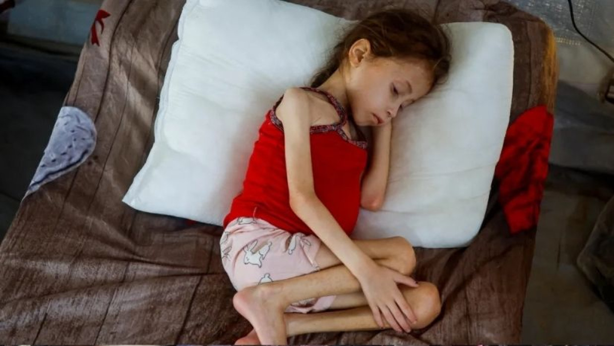 গাজায় মানবসৃষ্ট দুর্ভিক্ষ 