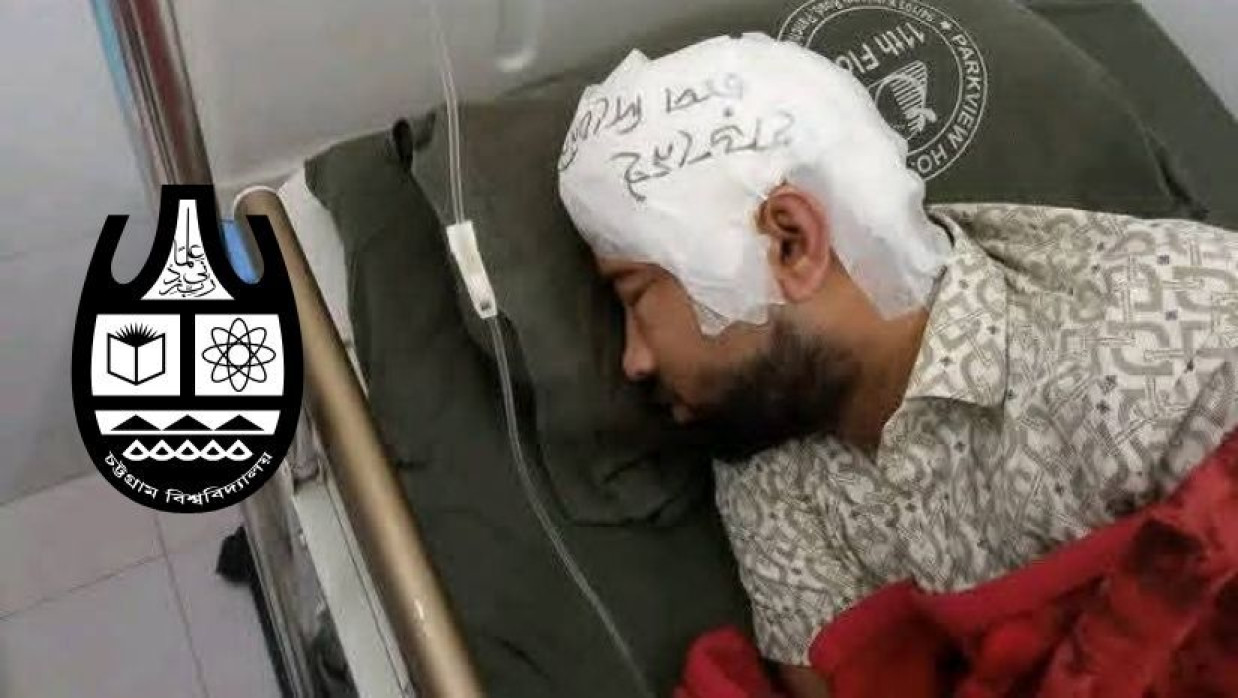 হাসপাতালে চিকিৎসাধীন চট্টগ্রাম বিশ্ববিদ্যালয়ের সমাজতত্ত্ব বিভাগের শিক্ষার্থী মো. মামুন মিয়া