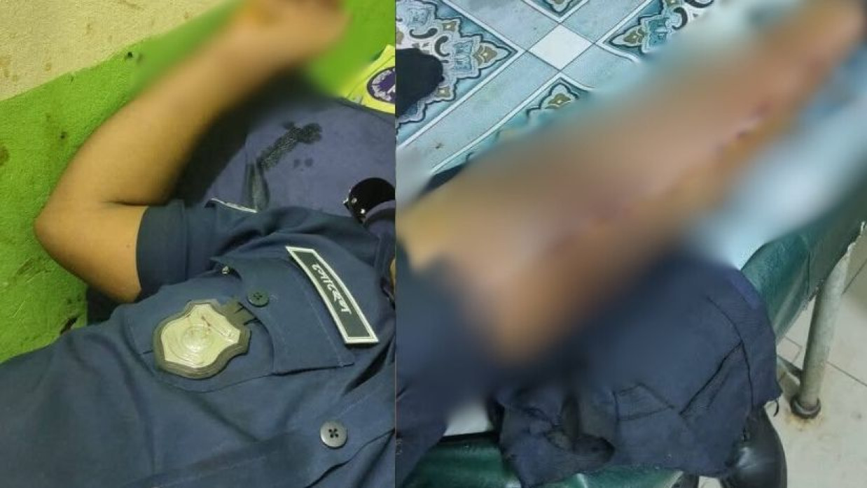 আহত তিন পুলিশ