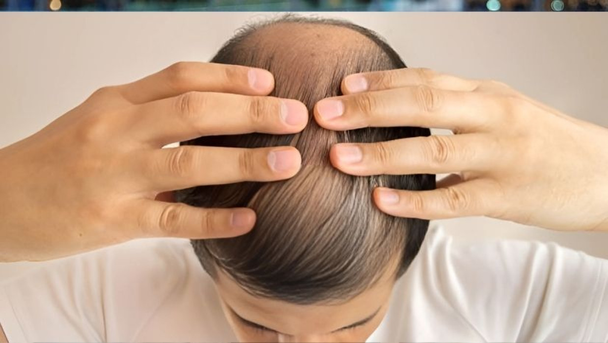 চুল পড়া বন্ধের উপায়