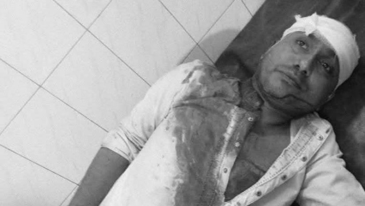 শ্রমিক অধিকার পরিষদের কেন্দ্রীয় সভাপতির ওপর সন্ত্রাসী হামলা