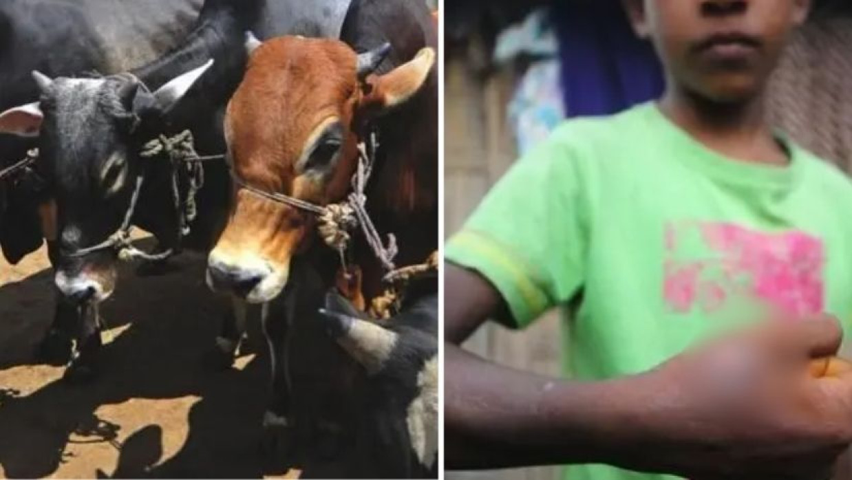 গবাদি পশু ও এক শিশুর শরীরে অ্যানথ্রাক্স শনাক্ত