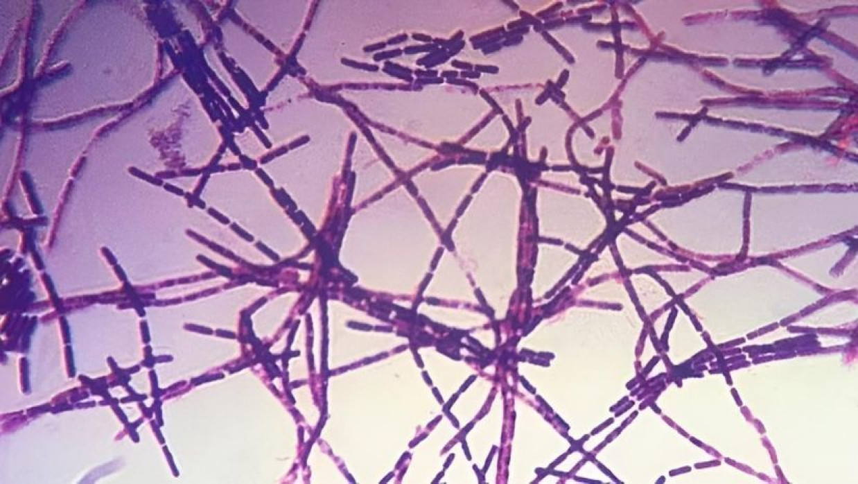 অ্যানথ্রাক্সের জীবানুর আনুবীক্ষনিক রূপ