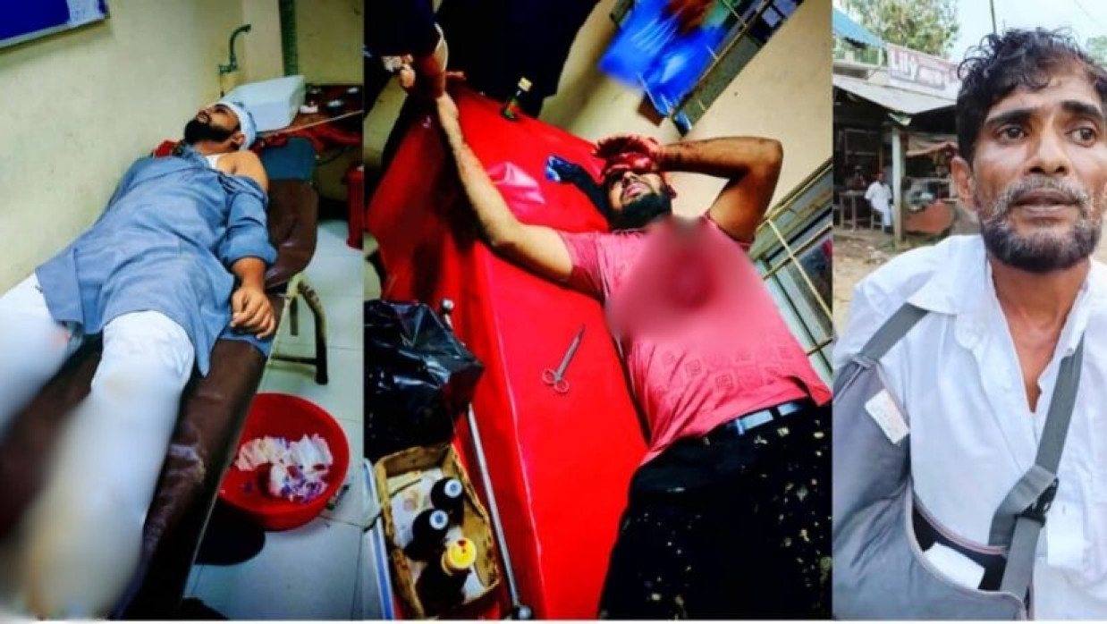 বিএনপি-জামায়াত সংঘর্ষে আহতরা