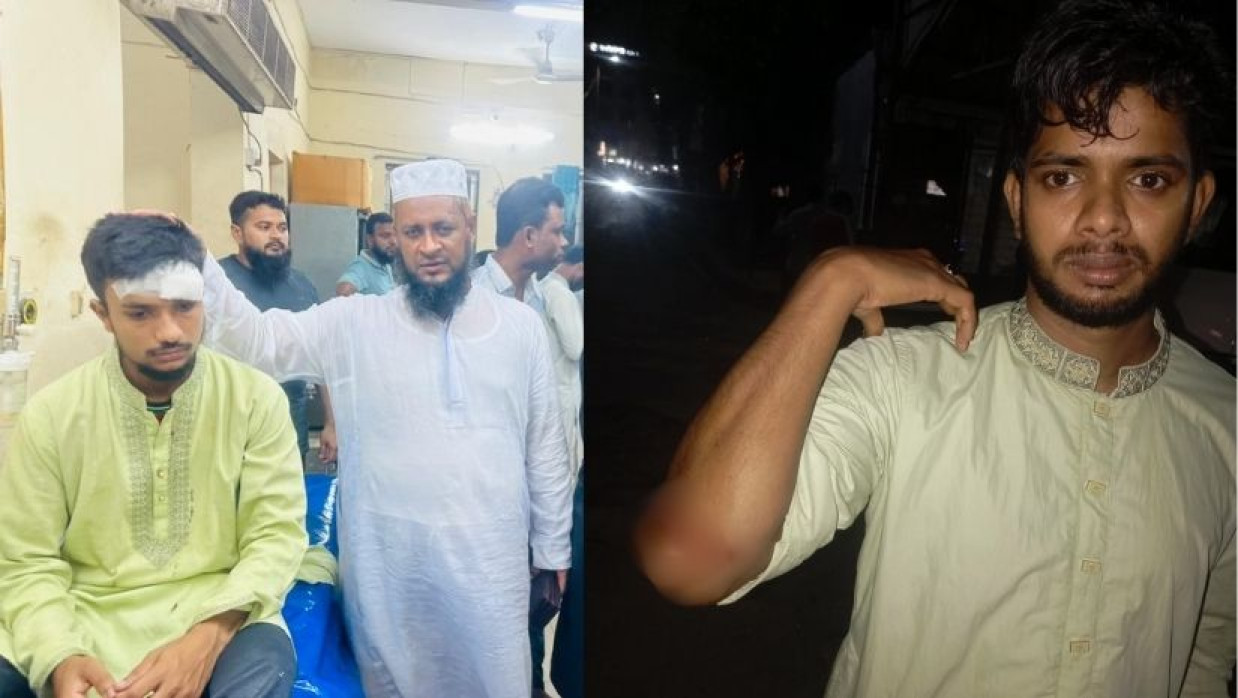 আহত জামায়াত শিবিরের নেতাকর্মীরা হাসপাতালে ভর্তি