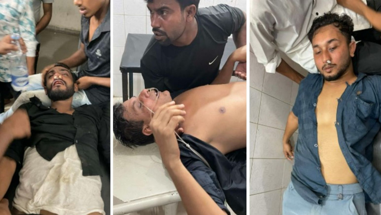 আলোচনা সভায় সংঘর্ষের ঘটনায় আহত