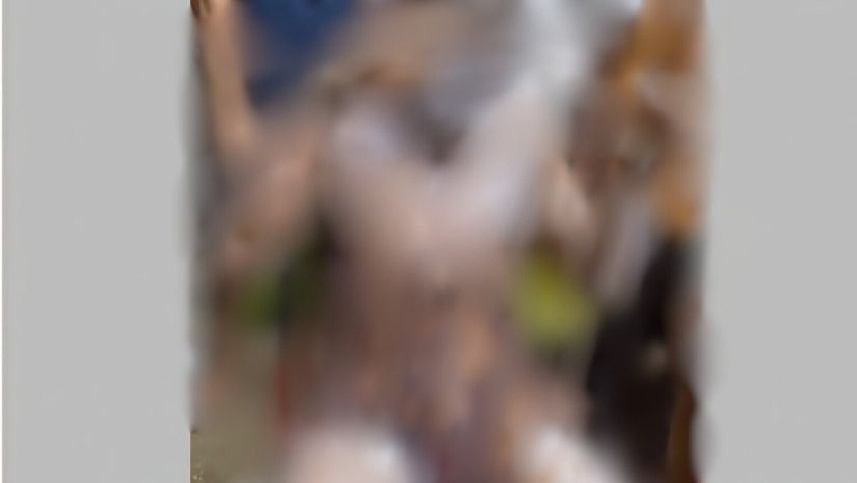 দগ্ধ যুবক