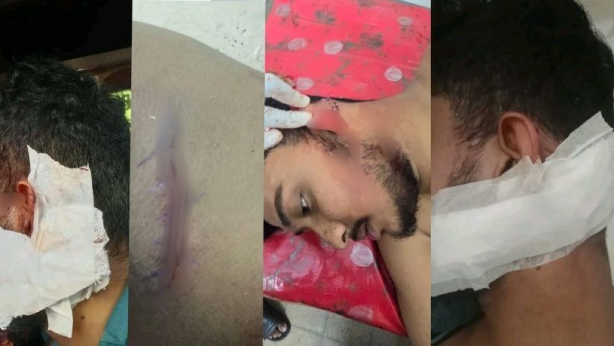 আহতরা হাসপাতলে