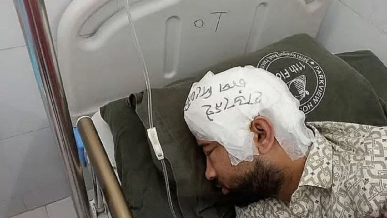 চবি শিক্ষার্থী মামুনের মাথার খুলি প্রতিস্থাপন