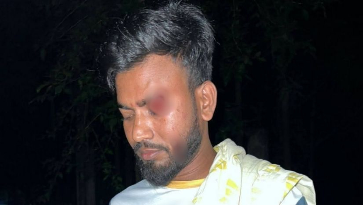 মনোনয়ন পেয়ে ভাইয়ের সমর্থকদের ওপর হামলার অভিযোগ