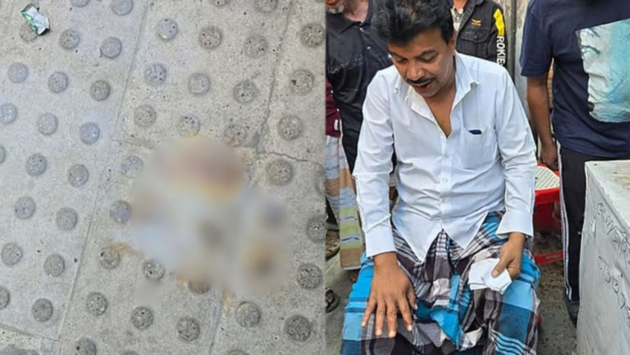 বিস্ফোরণে আহত ব্যক্তি