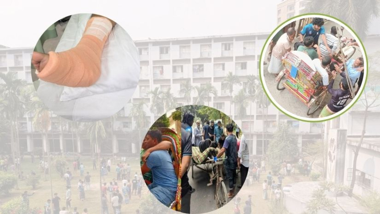 ঢাবিতে আহত শিক্ষার্থীরা