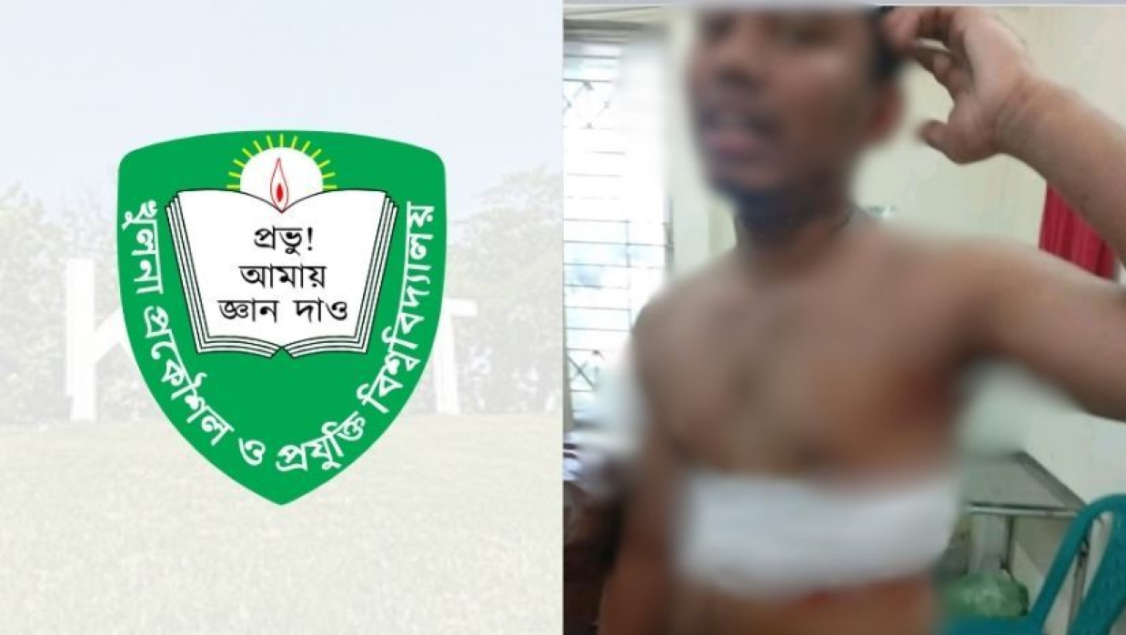 কুয়েটের লোগো ও আহত শিক্ষার্থী