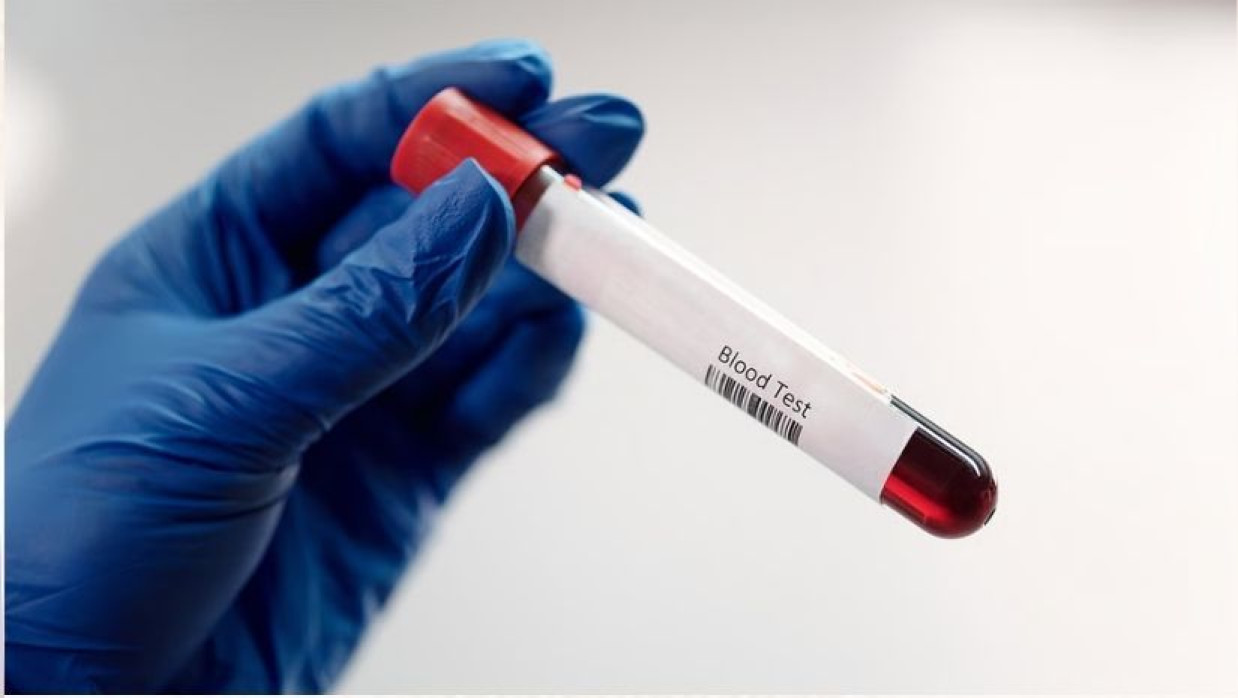 রক্তের গ্রুপ পরীক্ষা