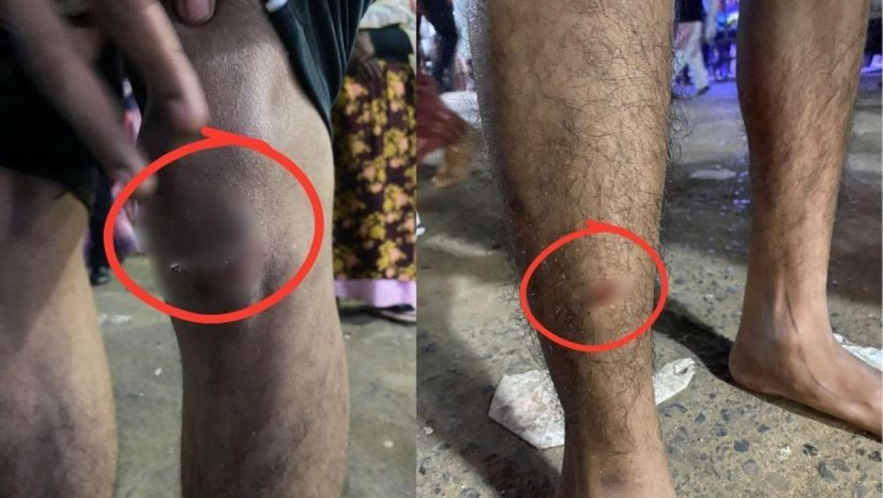 শিক্ষার্থীকে মারধর