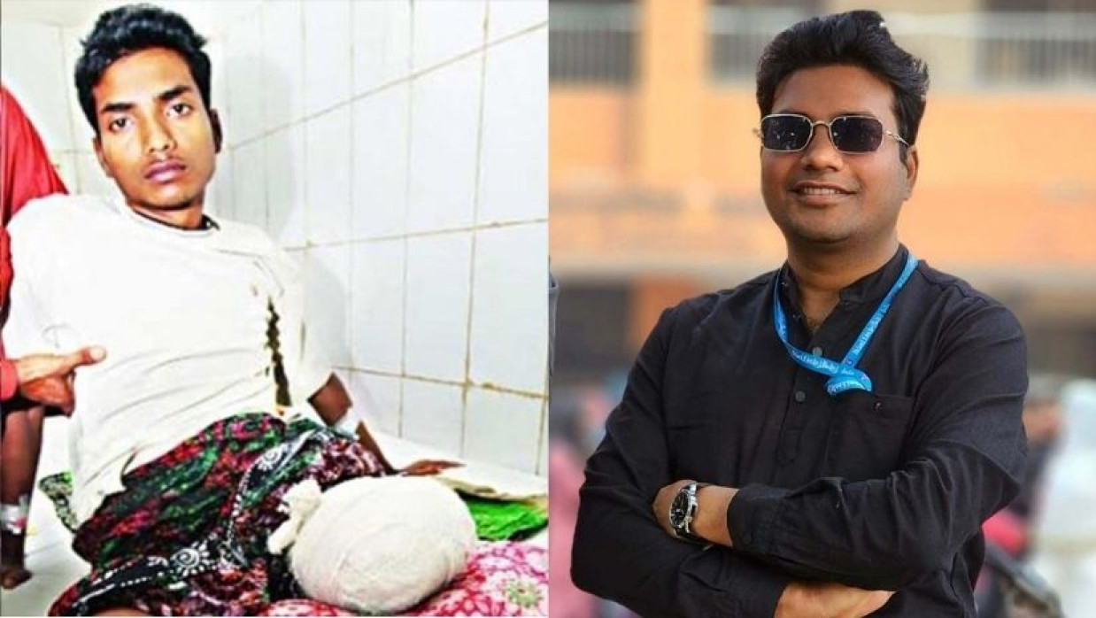 ‘র‌্যাবের গুলিতে পা হারানো’ লিমন