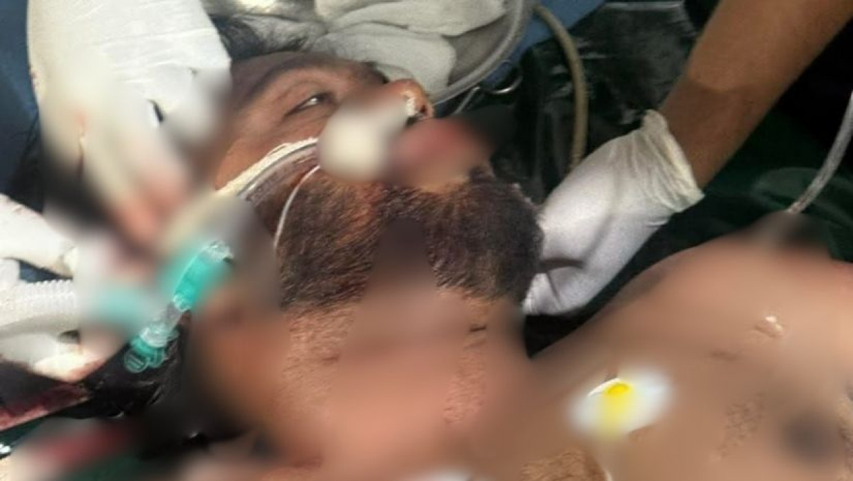 হাসপাতালে শরিফ ওসমান বিন হাদী 