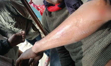 যশোরে বিএনপির নেতাকে হাতুড়িপেটা