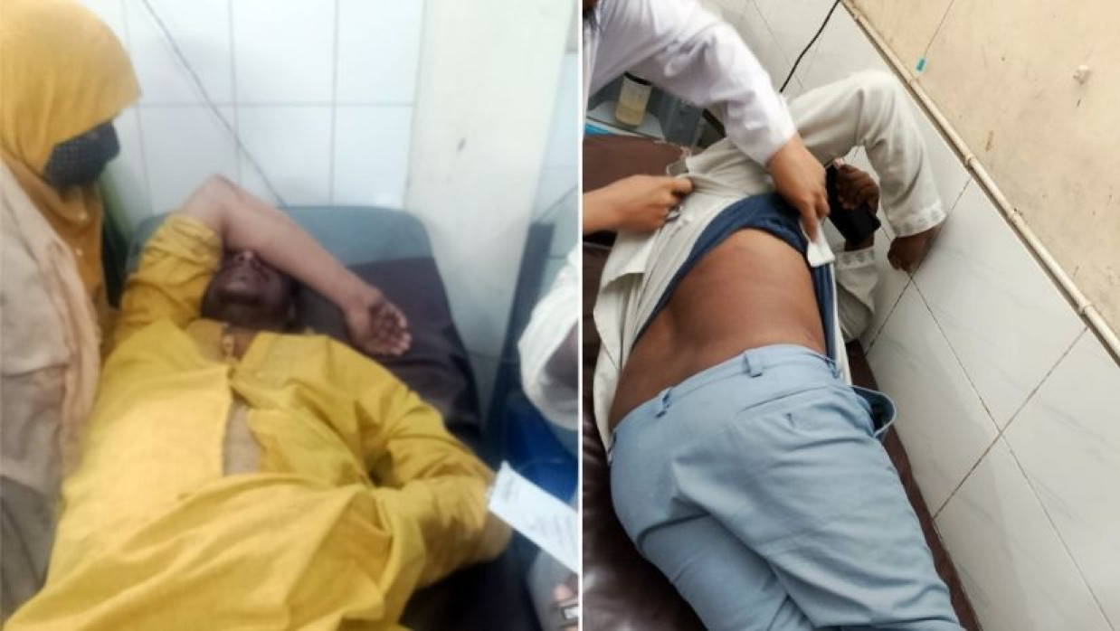 এবার জামায়াতের নির্বাচনী প্রচারণায় বিএনপির হামলা 