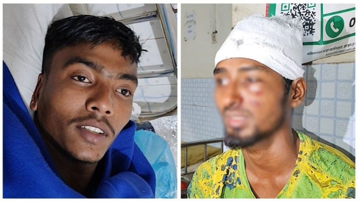 বাউফলে ভোট চাওয়া নিয়ে বিএনপি-জামায়াতের সংঘর্ষ, আহত-২