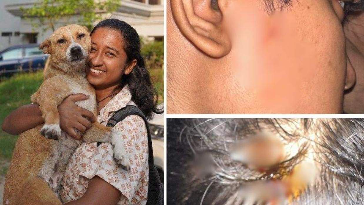 ঢাবিতে ছাত্র ইউনিয়ন নেত্রীর সঙ্গে হাতাহাতি, জুনিয়রকে মাথা ফাটানোর অভিযোগ