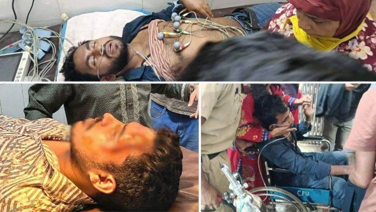 আহতদের হাসপাতালে ভর্তি করা হয়েছে