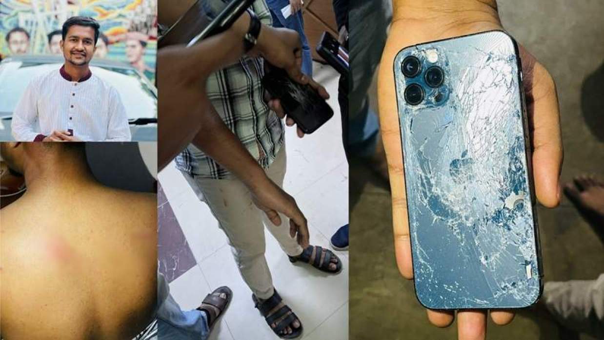 জিডি করতে থানায় গেলে ঢাবি ছাত্রকে পেটায় পুলিশ, ভেঙে দেয় আইফোন
