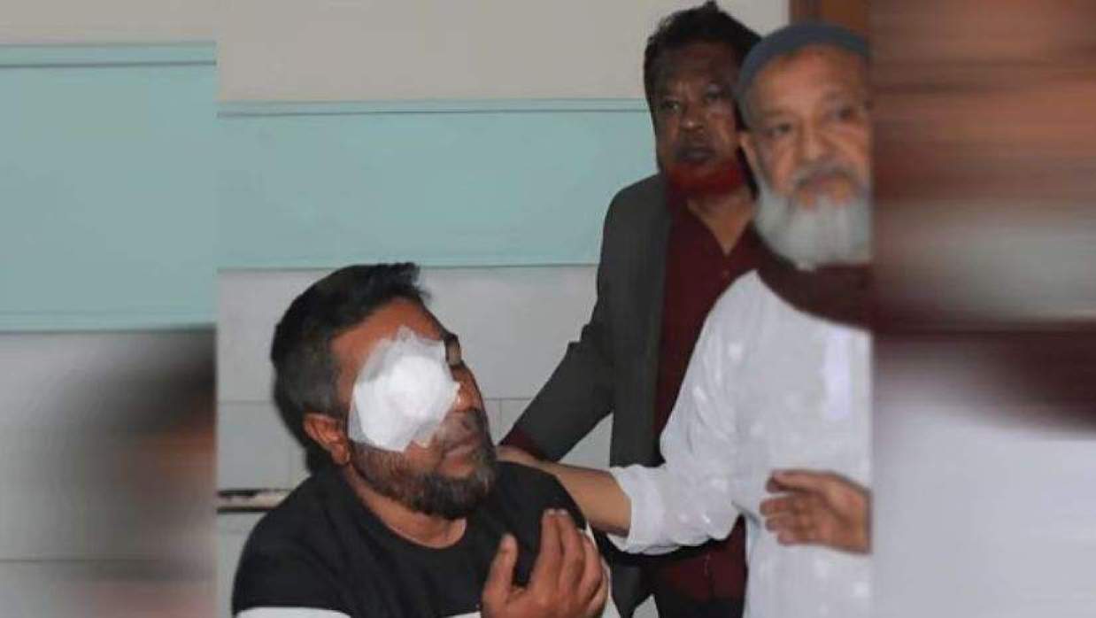 দাঁড়িপাল্লার পক্ষে ভোট কেনার অভিযোগে দুজন আটকের জেরে বিএনপি-জামায়াত সংঘর্ষের ঘটনা ঘটেছে