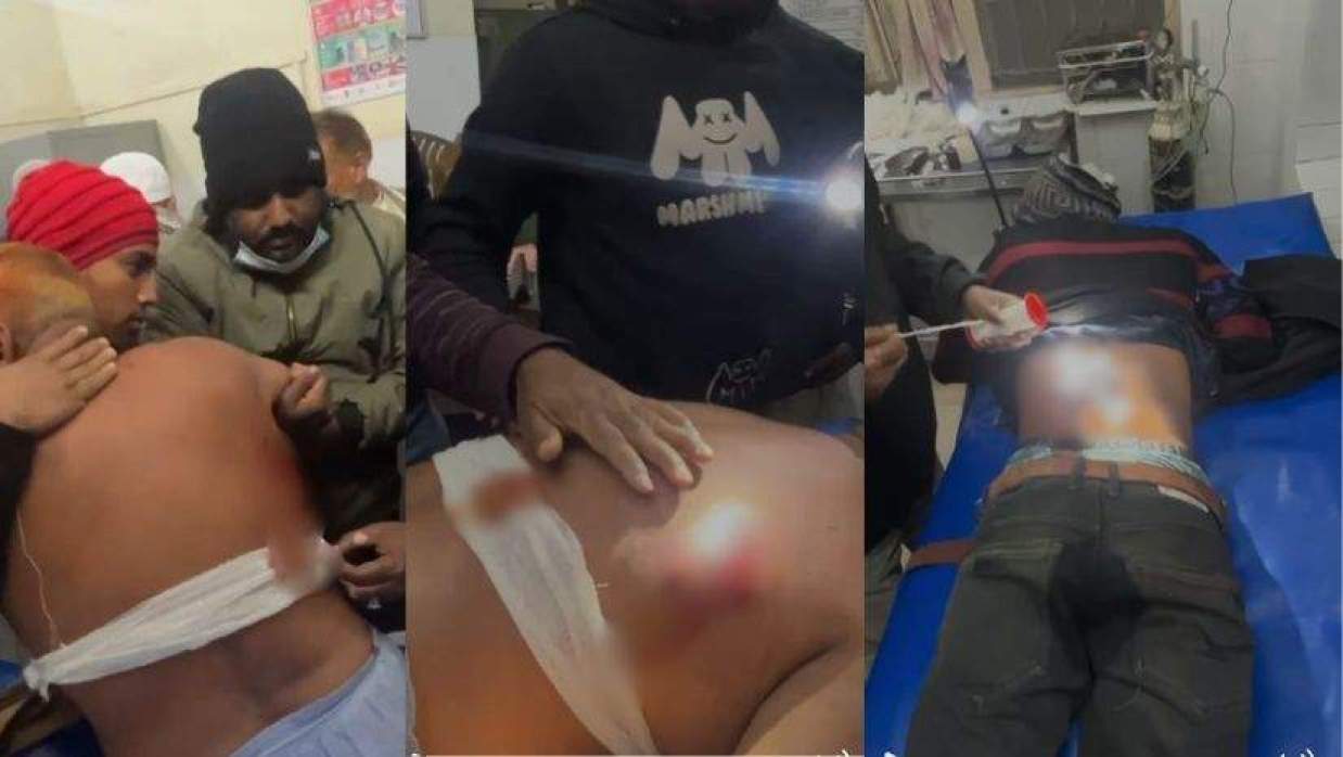 বিএনপির হামলায় আহত জামায়াতের নেতাকর্মীর