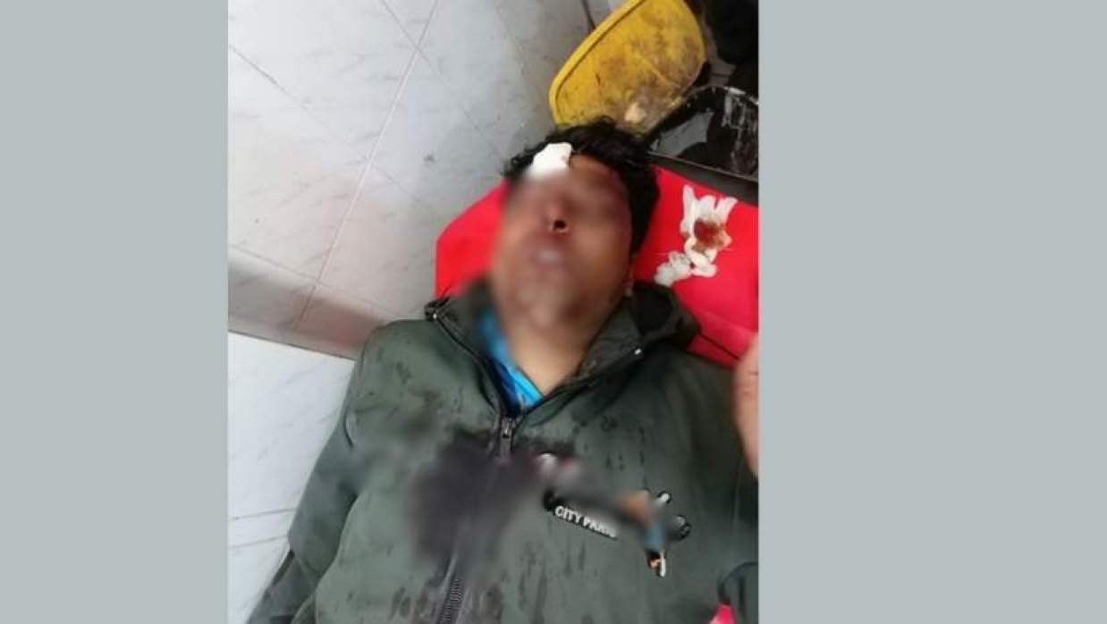 আহত নেতা