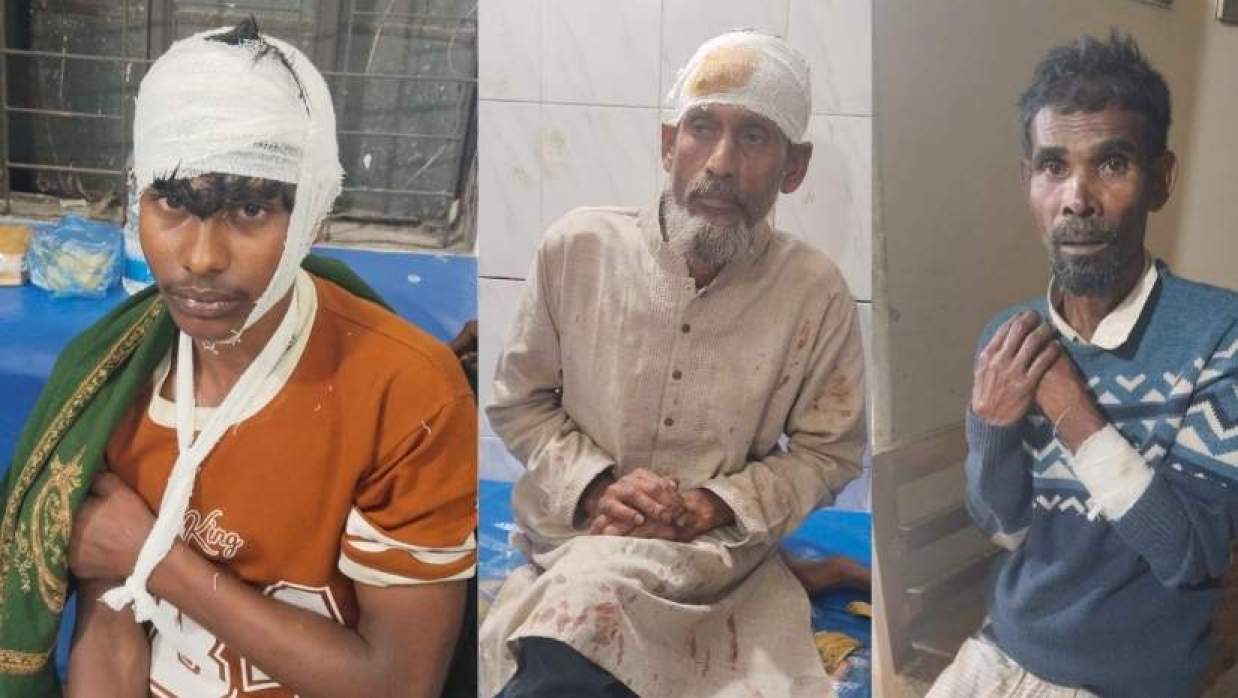  আ. লীগ নেতাদের হামলায় বিএনপির ৫ নেতাকর্মী আহত