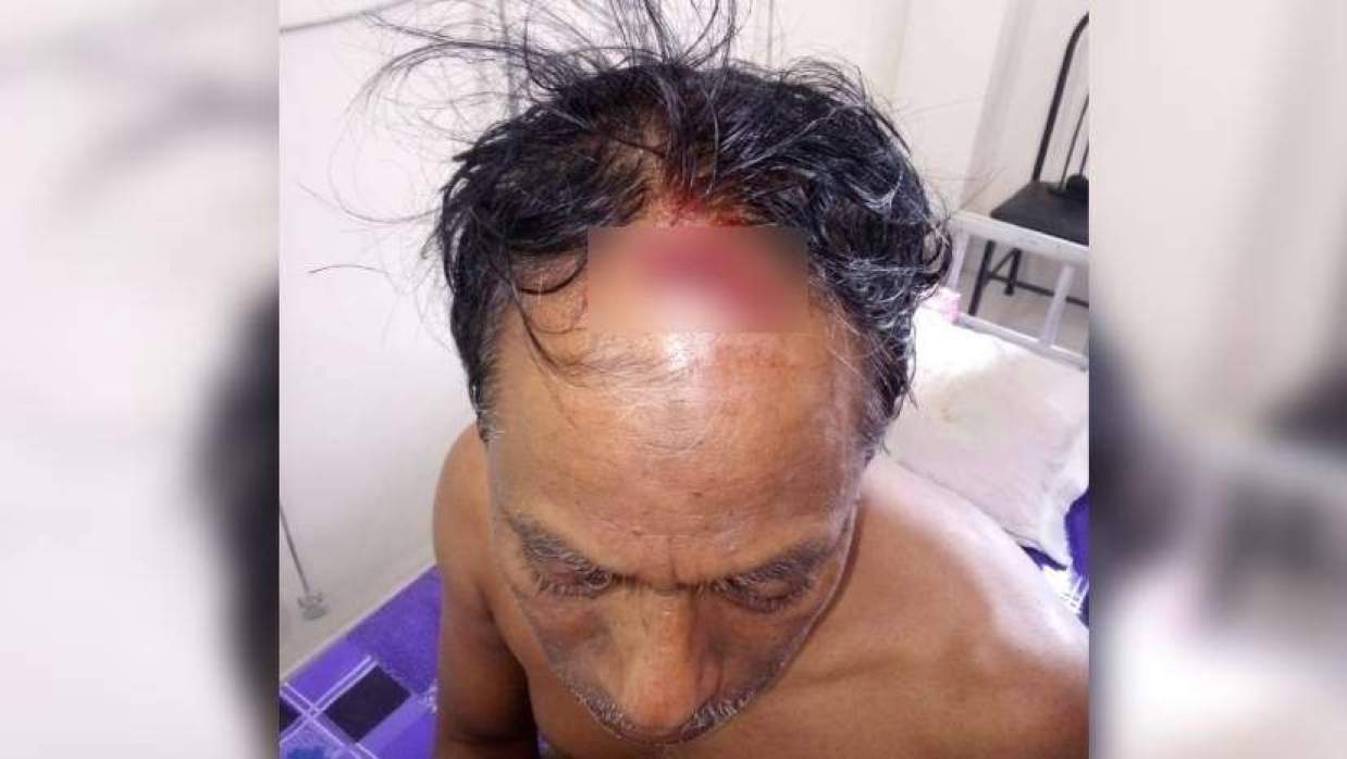 আহত মোহাম্মদ রেজাউল করিম