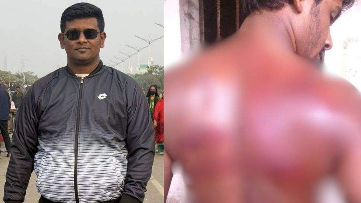 ১০ বছর আগে ঢাবির হল থেকে বের করে নির্যাতন ছাত্রলীগের, মামলার প্রস্তুতি ছাত্রদল নেতার