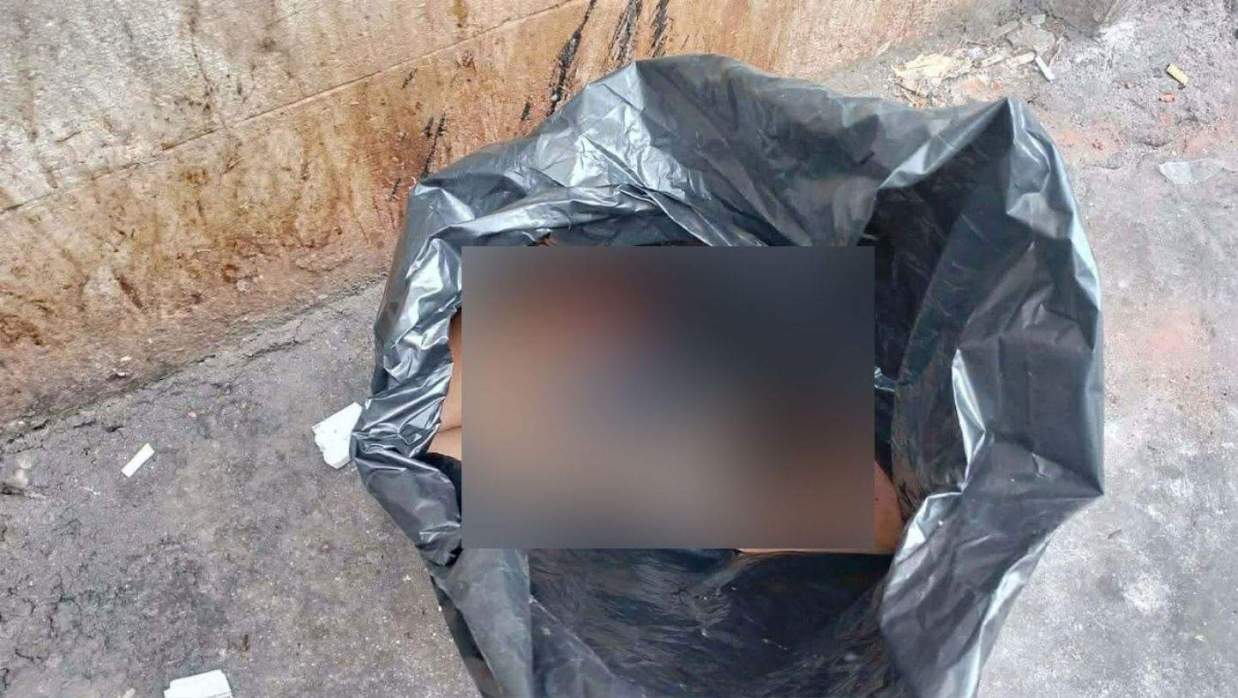 উদ্ধার হওয়া খণ্ডিত হাত-পা 