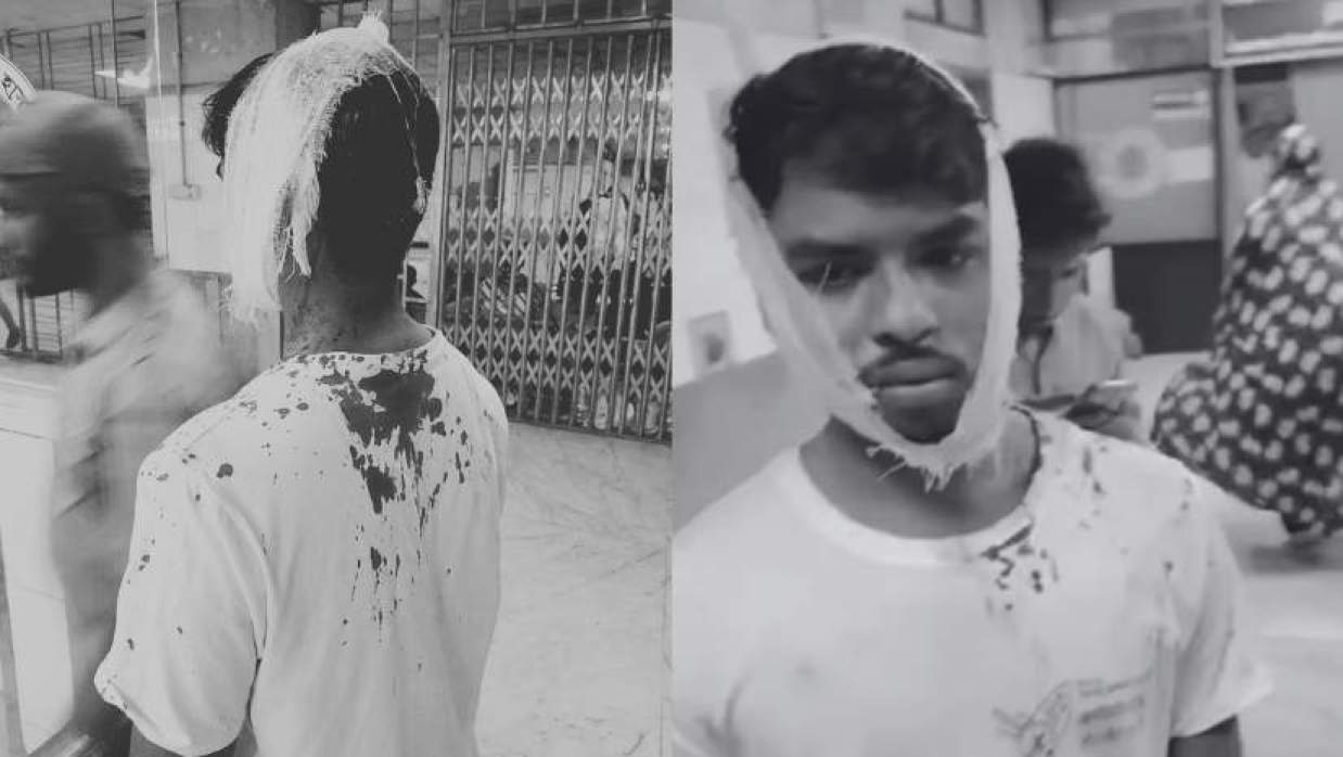 মধ্যরাতে ঢাকা পলিটেকনিকে ছাত্রদল-শিবির সংঘর্ষ, মেডিকেলে ভর্তি ৬